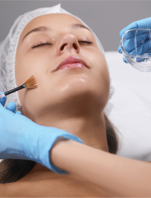 Chemical Peel Training Course